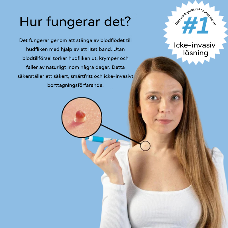 𝐉𝐚𝐬𝐬𝐞𝐞𝐦®-𝐒𝐤𝐢𝐧 𝐓𝐚𝐠 𝐁𝐨𝐫𝐭𝐭𝐚𝐠𝐧𝐢𝐧𝐠𝐬𝐤𝐢𝐭（En verklig fysisk lösning för att ta bort hudflikar）🌼💖