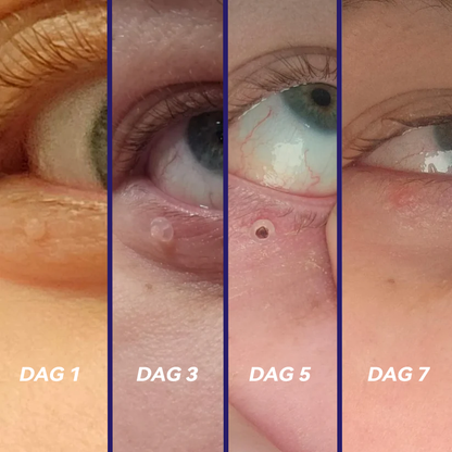 𝐉𝐚𝐬𝐬𝐞𝐞𝐦®-𝐒𝐤𝐢𝐧 𝐓𝐚𝐠 𝐁𝐨𝐫𝐭𝐭𝐚𝐠𝐧𝐢𝐧𝐠𝐬𝐤𝐢𝐭（En verklig fysisk lösning för att ta bort hudflikar）🌼💖