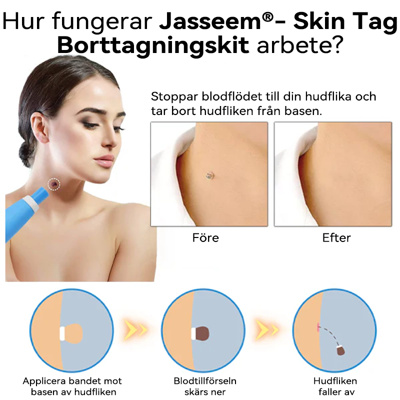 𝐉𝐚𝐬𝐬𝐞𝐞𝐦®-𝐒𝐤𝐢𝐧 𝐓𝐚𝐠 𝐁𝐨𝐫𝐭𝐭𝐚𝐠𝐧𝐢𝐧𝐠𝐬𝐤𝐢𝐭（En verklig fysisk lösning för att ta bort hudflikar）🌼💖