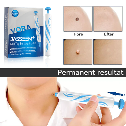 𝐉𝐚𝐬𝐬𝐞𝐞𝐦®-𝐒𝐤𝐢𝐧 𝐓𝐚𝐠 𝐁𝐨𝐫𝐭𝐭𝐚𝐠𝐧𝐢𝐧𝐠𝐬𝐤𝐢𝐭（En verklig fysisk lösning för att ta bort hudflikar）🌼💖