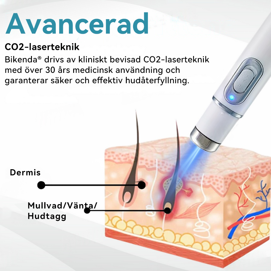 Bikenda®🍁💖 laserpenna (med CO₂-laserteknik – effektiv för att ta bort födelsemärken, vårtor, hudflikar, pigmentfläckar och andra hudproblem)